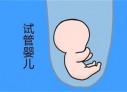 培养贵阳捐卵宝宝艺术细胞的小技巧